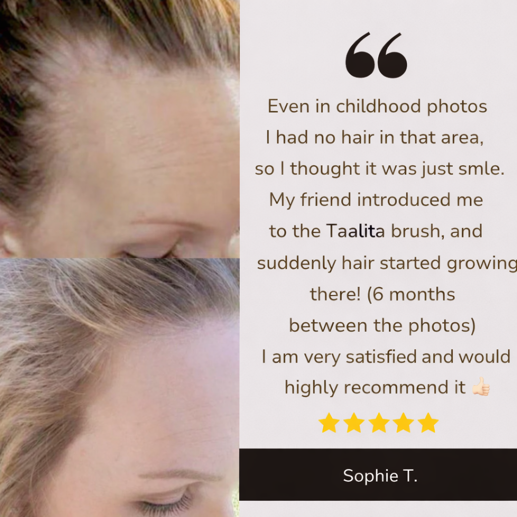 Hair Grow Brush - The Solution to Hair Loss