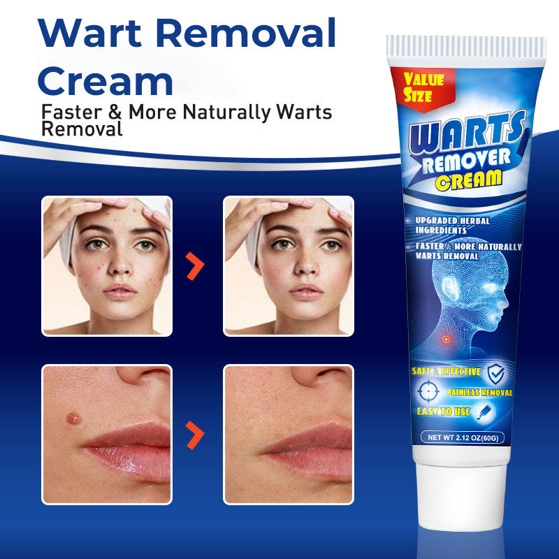 Wart Removal Face Cream