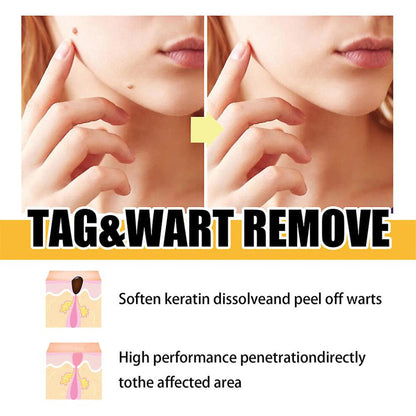 Targeted Skin Treatment Pen with Precision Applicator 3 ml