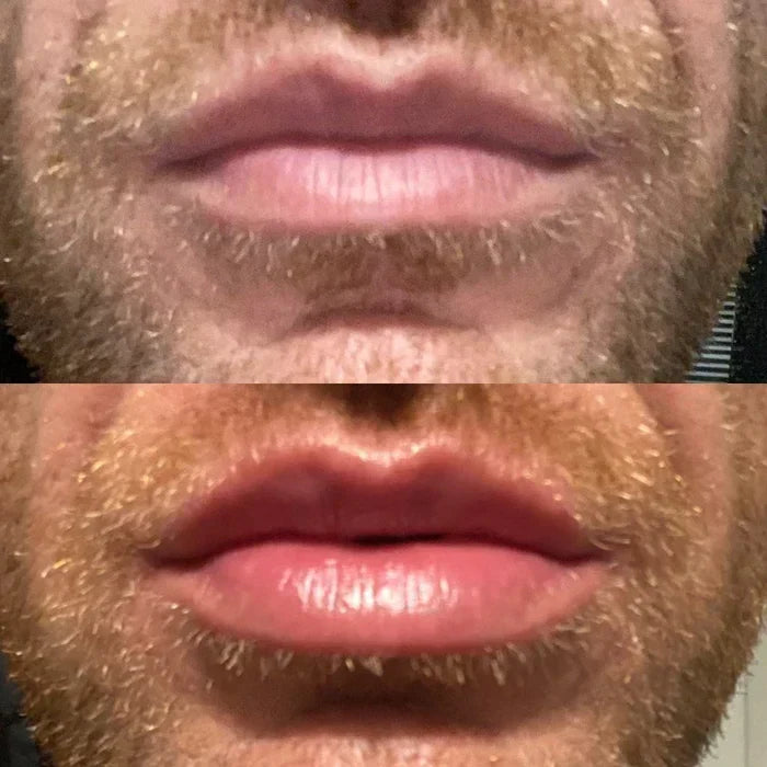 Instant Lip Plumping Serum
