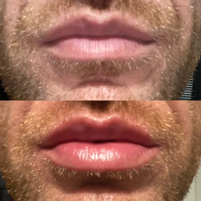 Achieve Fuller Lips Quickly with Lip Plumper Serum