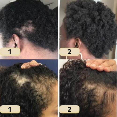 Nourishing Hair Elixir with 11 Essential Oils | Scalp & Hair Care | Vegan, Silicone-Free, Paraben-Free