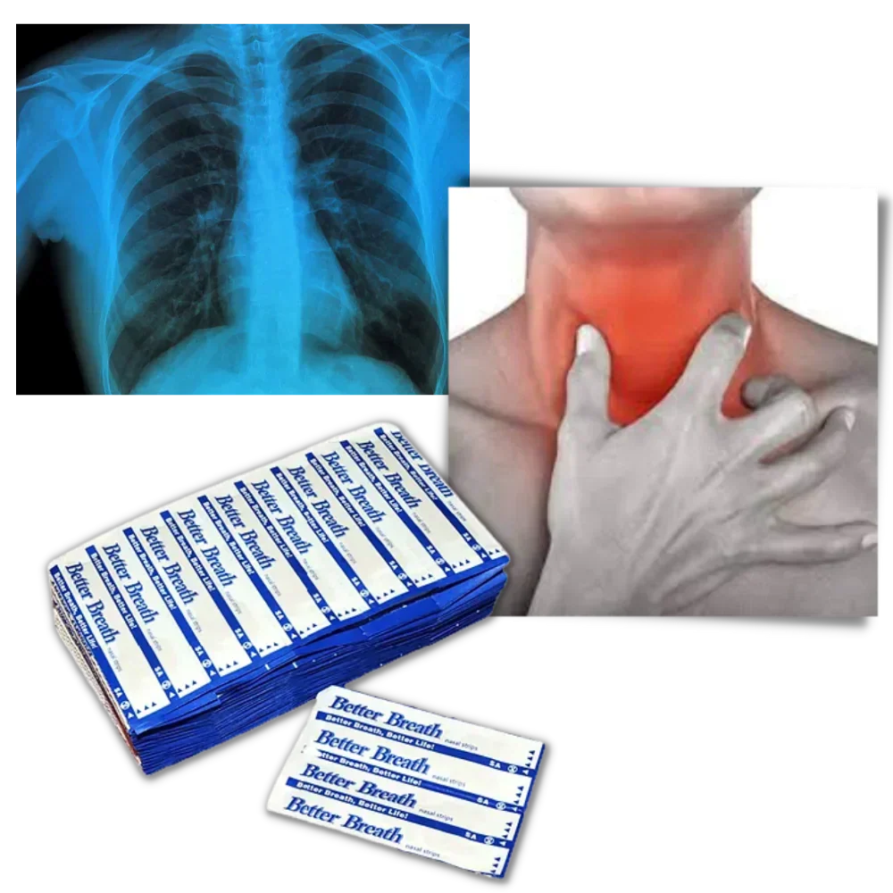 100-Pack Nose Strips for Snoring Relief