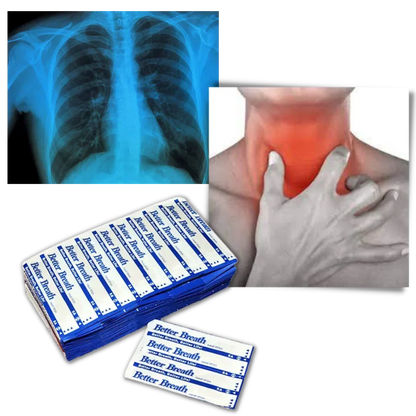 100-Pack Nose Strips for Snoring Relief