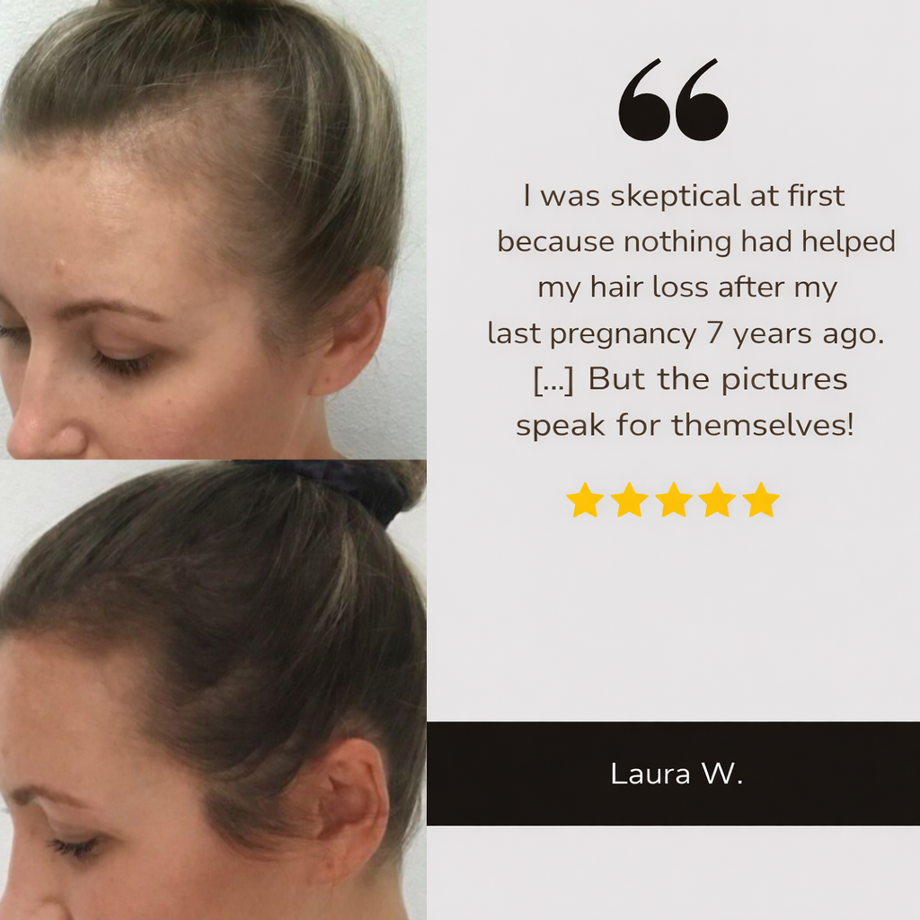 Hair Grow Brush - The Solution to Hair Loss