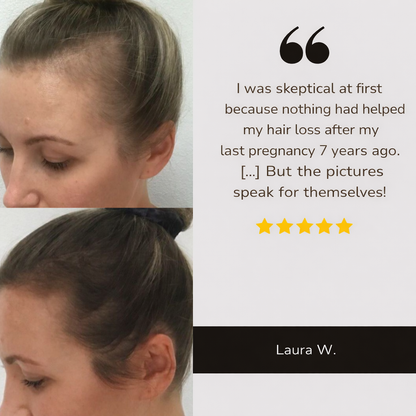Hair Grow Brush - The Solution to Hair Loss