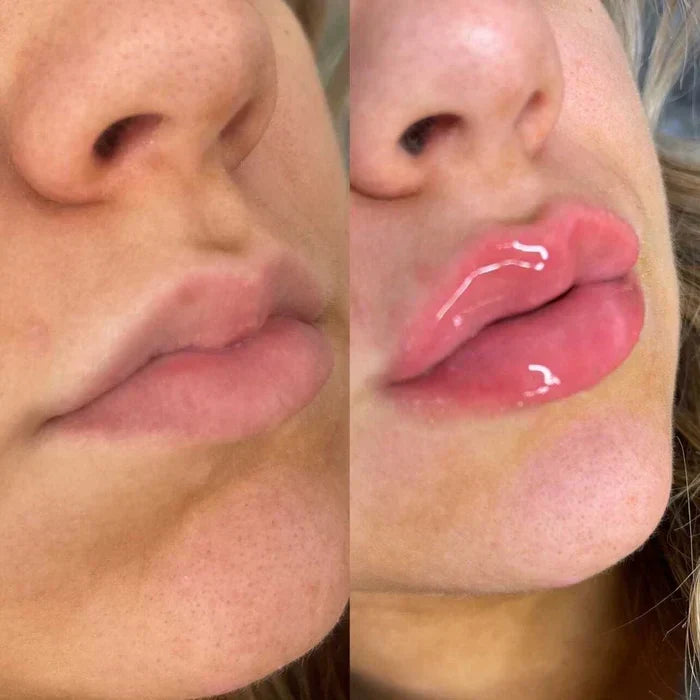 Instant Lip Plumping Serum