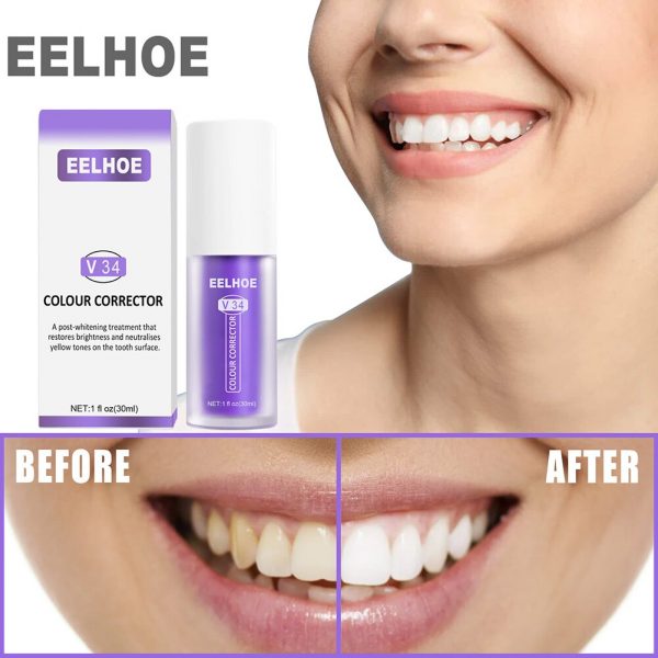 BrightSmile Color Correction Serum