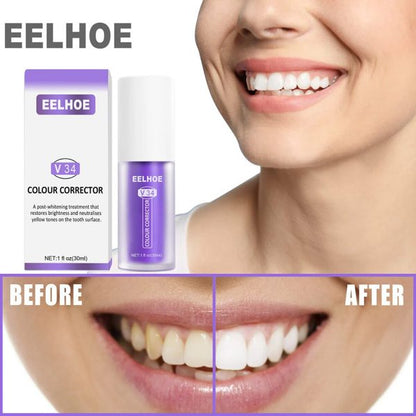 BrightSmile Color Correction Serum