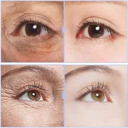 RevitaEyes Instant Eye Cream – Anti-Aging, Dark Circles & Puffiness Treatment