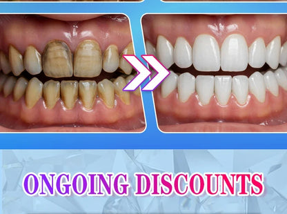 PureWhite Powder — Tooth Whitening + Plaque Removal Mineral Formula