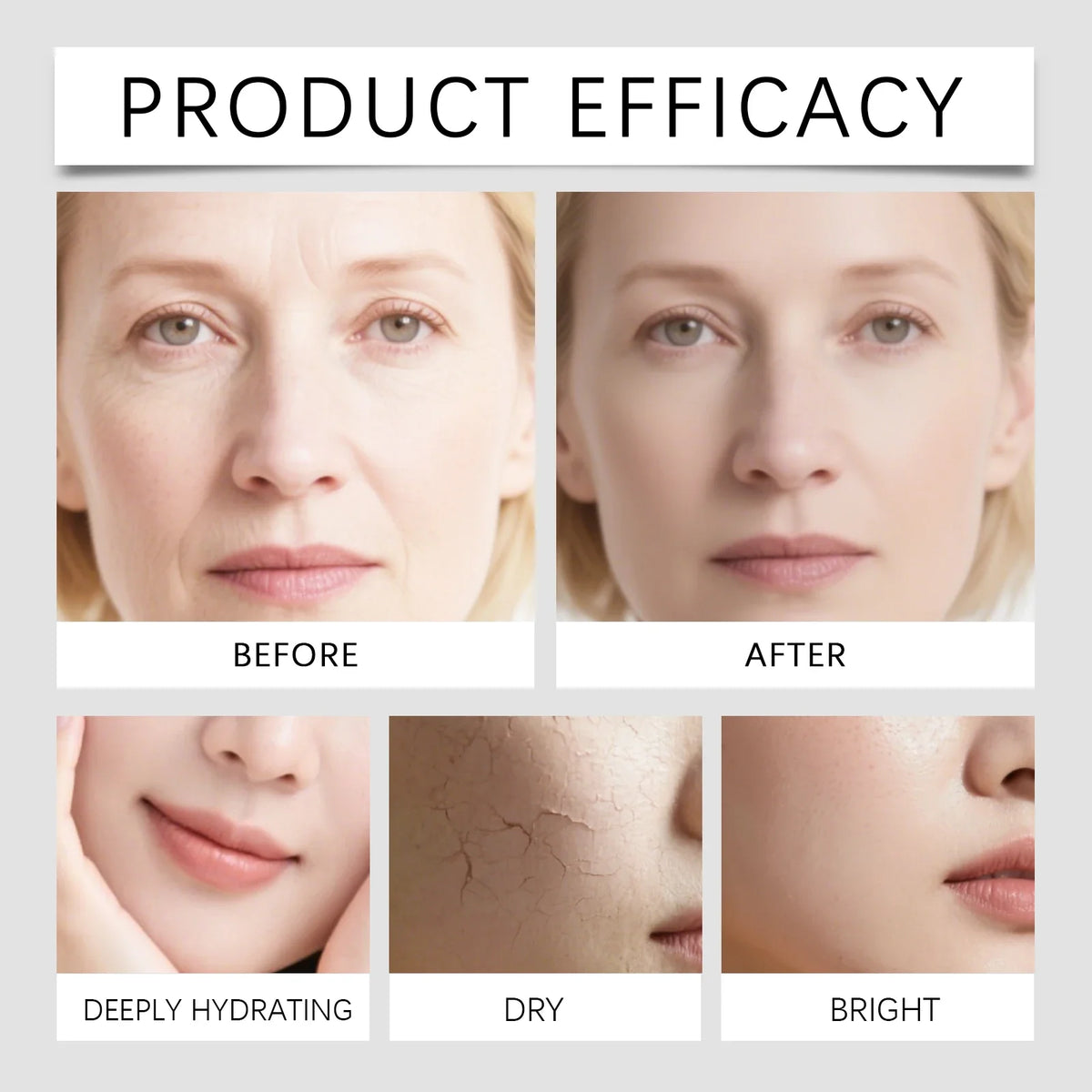 GlowNeedle 0.25 Micro-Infusion Skin Renewal System