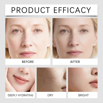 GlowNeedle 0.25 Micro-Infusion Skin Renewal System