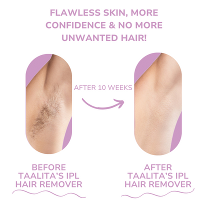 S IPL Hair Remover I The leading laser hair removal for your home