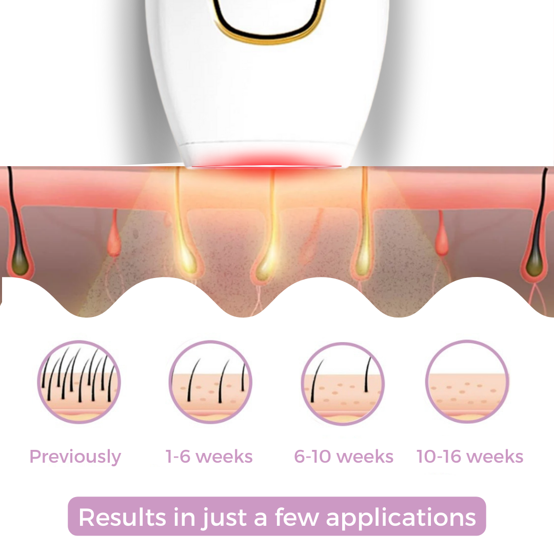 S IPL Hair Remover I The leading laser hair removal for your home