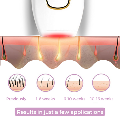 S IPL Hair Remover I The leading laser hair removal for your home